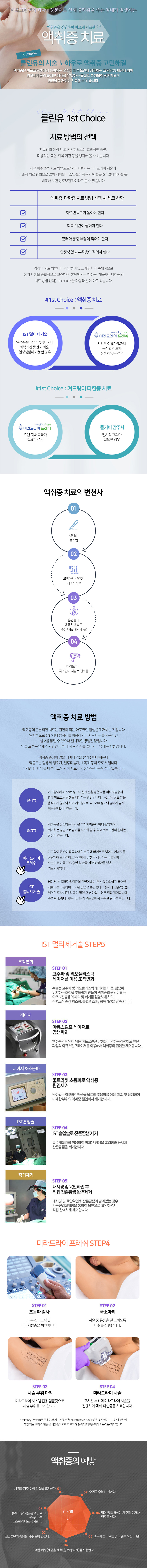 액취증치료방법